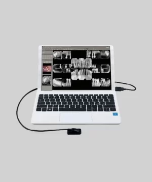 X-VS Intraoral Sensor